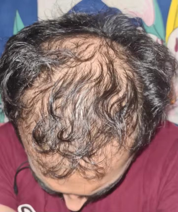 Resultado inicial de Héctor V.